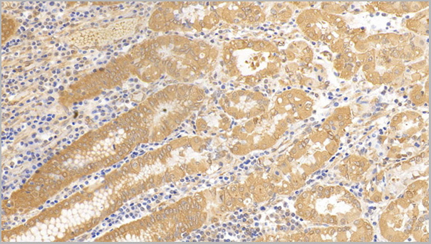 product-image-AAA21200_IHC2.jpg