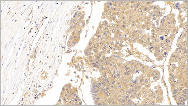 product-image-AAA21200_IHC3.jpg