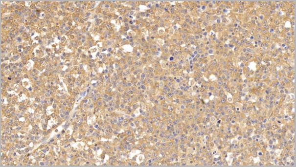 product-image-AAA21200_IHC4.jpg