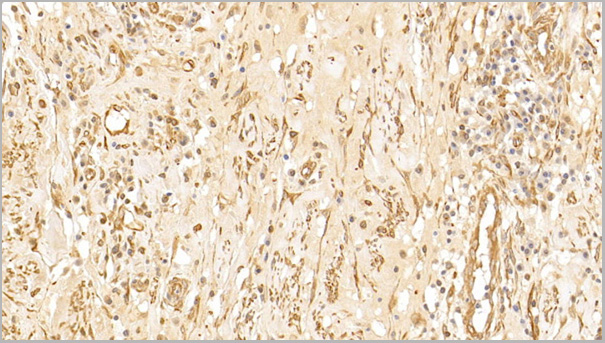product-image-AAA21200_IHC5.jpg