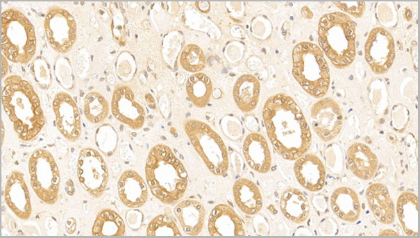 product-image-AAA21200_IHC6.jpg
