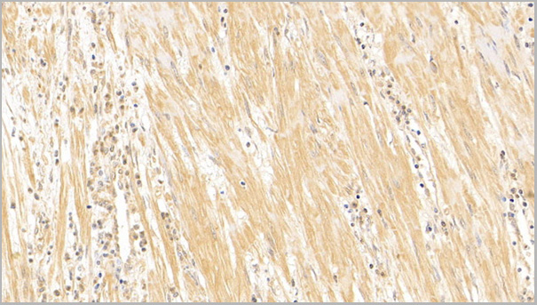 product-image-AAA21200_IHC7.jpg