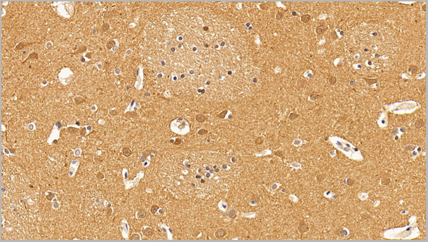 product-image-AAA21201_IHC2.jpg