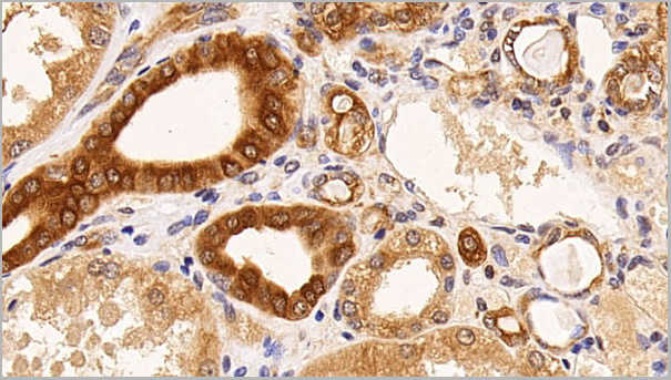 product-image-AAA21201_IHC4.jpg