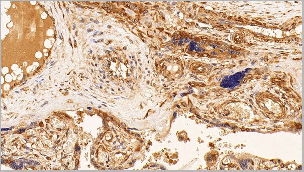 product-image-AAA21201_IHC5.jpg