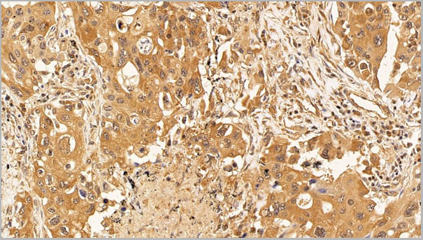 product-image-AAA21201_IHC6.jpg