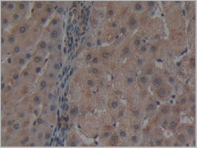 product-image-AAA21202_IHC.jpg