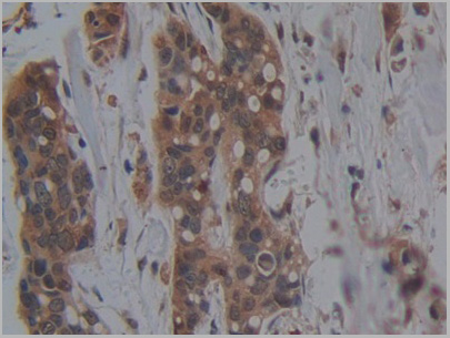 product-image-AAA21202_IHC2.jpg