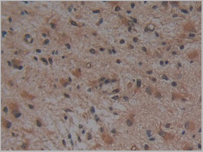product-image-AAA21202_IHC3.jpg
