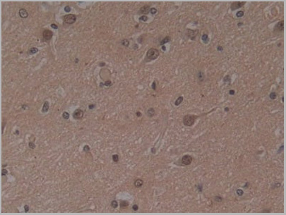 product-image-AAA21202_IHC4.jpg