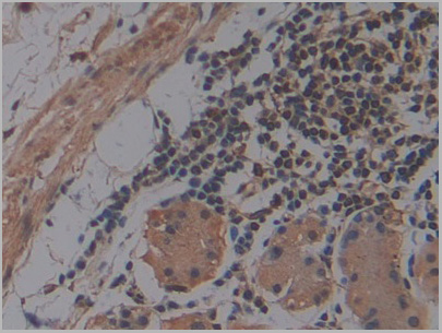 product-image-AAA21202_IHC5.jpg