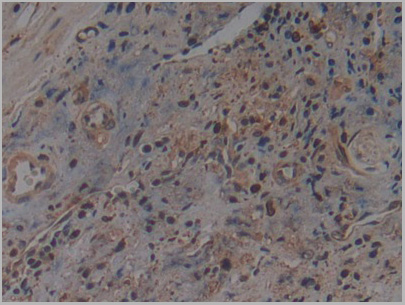 product-image-AAA21202_IHC6.jpg