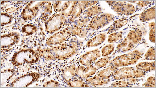 product-image-AAA21203_IHC.jpg