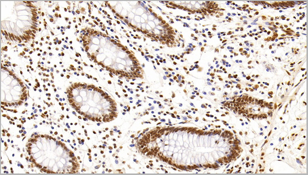 product-image-AAA21203_IHC2.jpg