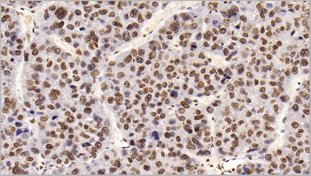 product-image-AAA21203_IHC3.jpg