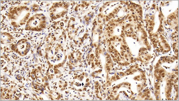 product-image-AAA21203_IHC4.jpg