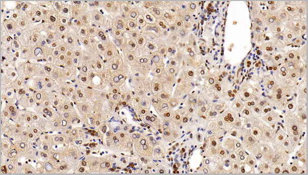 product-image-AAA21203_IHC5.jpg