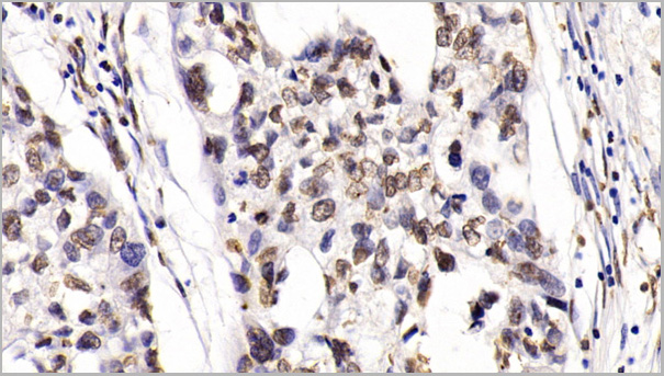 product-image-AAA21203_IHC6.jpg