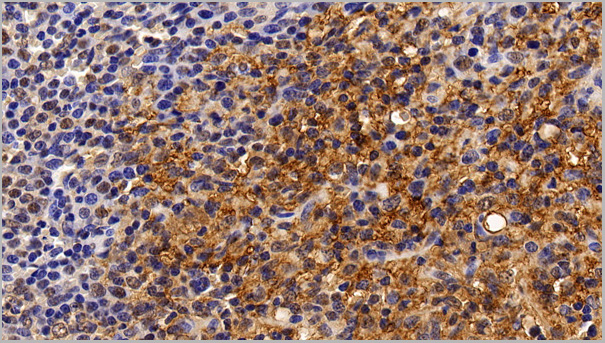 product-image-AAA21204_IHC.jpg
