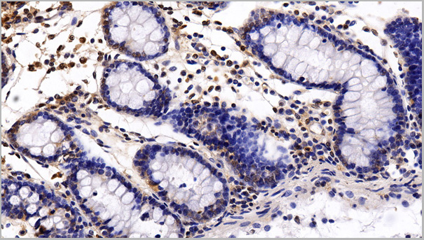 product-image-AAA21204_IHC2.jpg