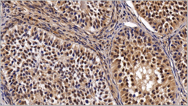 product-image-AAA21204_IHC3.jpg