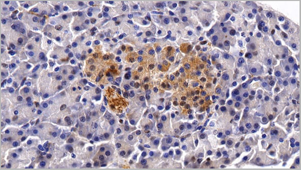 product-image-AAA21204_IHC4.jpg