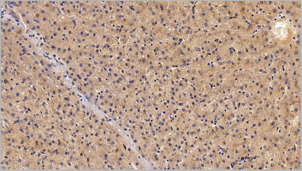 product-image-AAA21204_IHC5.jpg