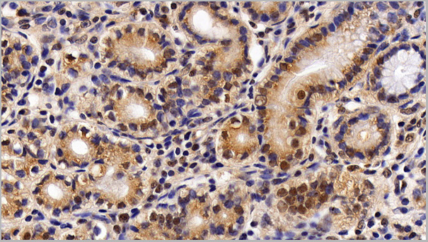 product-image-AAA21204_IHC6.jpg