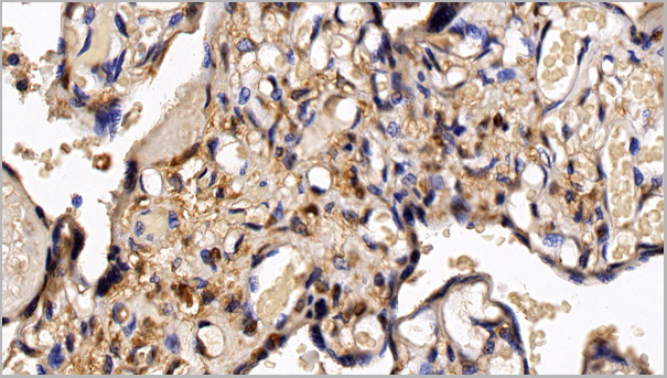 product-image-AAA21205_IHC.jpg