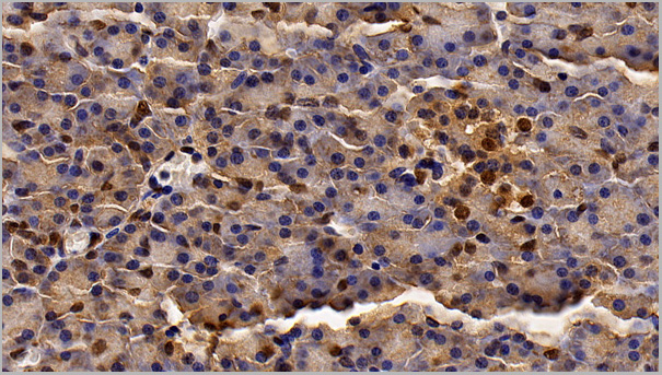product-image-AAA21205_IHC2.jpg