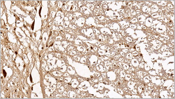 product-image-AAA21205_IHC3.jpg