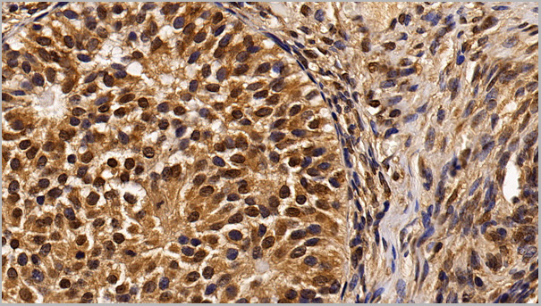product-image-AAA21205_IHC5.jpg