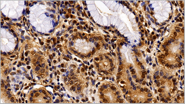 product-image-AAA21205_IHC6.jpg