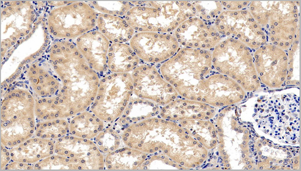 product-image-AAA21206_IHC2.jpg