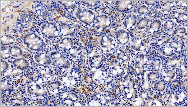 product-image-AAA21206_IHC6.jpg