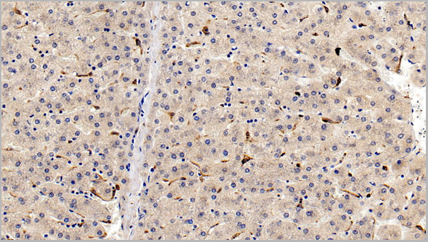 product-image-AAA21206_IHC7.jpg