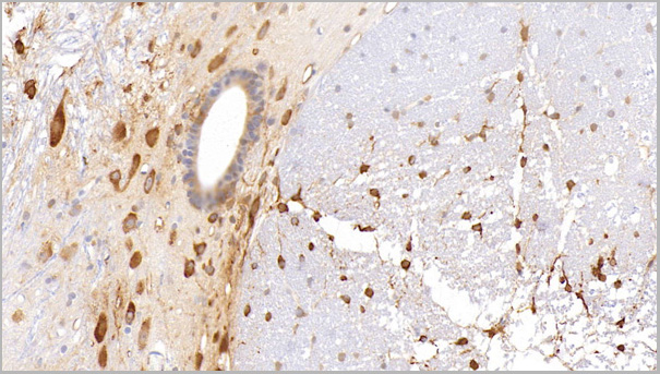 product-image-AAA21207_IHC2.jpg