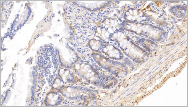 product-image-AAA21207_IHC6.jpg