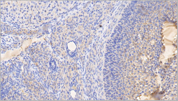 product-image-AAA21208_IHC2.jpg