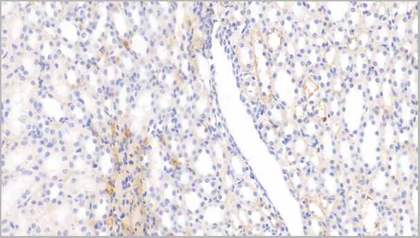 product-image-AAA21208_IHC3.jpg
