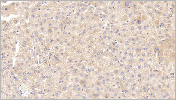 product-image-AAA21208_IHC4.jpg