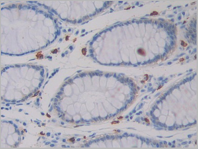 product-image-AAA21210_IHC.jpg