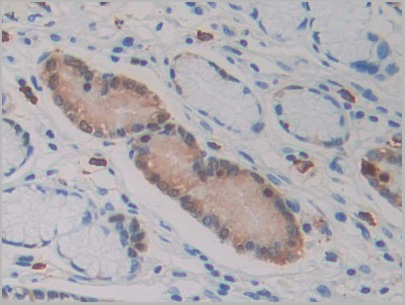 product-image-AAA21210_IHC2.jpg