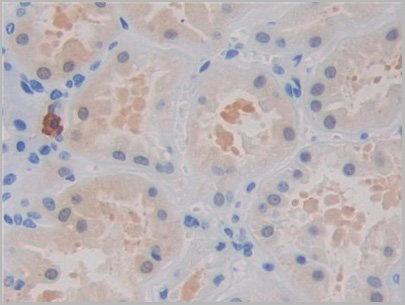 product-image-AAA21210_IHC3.jpg