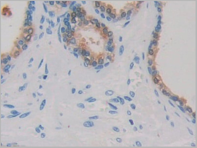 product-image-AAA21210_IHC4.jpg