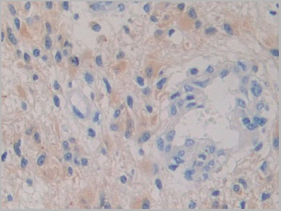 product-image-AAA21210_IHC5.jpg