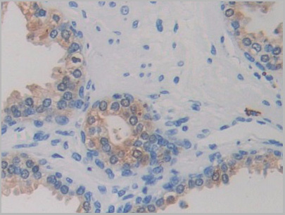 product-image-AAA21211_IHC2.jpg