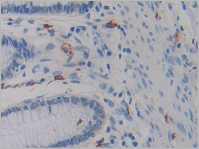 product-image-AAA21211_IHC3.jpg