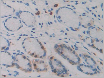 product-image-AAA21211_IHC5.jpg