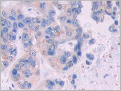 product-image-AAA21212_IHC.jpg